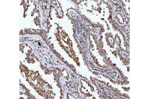 IHC analysis of BBS9 using anti-BBS9 antibody (ABIN7601518). (BBS9 antibody  (AA 37-793))