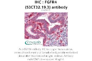 Image no. 2 for anti-Fibroblast Growth Factor Receptor 4 (FGFR4) antibody (ABIN2851987) (FGFR4 antibody)