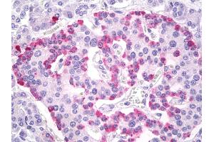 Anti-Glucagon antibody IHC of human pancreas, islets of Langerhans. (Glucagon antibody  (AA 25-54))
