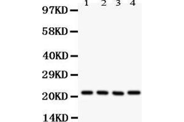 ATP5H Antikörper  (AA 2-161)