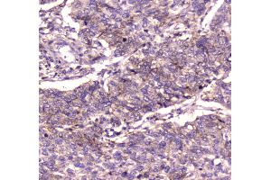 IHC analysis of IGF2R using anti-IGF2R antibody . (IGF2R antibody  (AA 424-529))