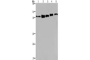 Western Blotting (WB) image for anti-Heterogeneous Nuclear Ribonucleoprotein L (HNRNPL) antibody (ABIN2433134) (HNRNPL antibody)