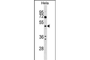 ALG2 Antibody (Center) (ABIN1538197 and ABIN2848872) western blot analysis in Hela cell line lysates (35 μg/lane).