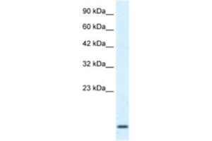 Western Blotting (WB) image for anti-Homeobox A1 (HOXA1) antibody (ABIN2461047) (HOXA1 antibody)