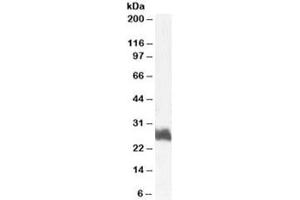 Western blot testing of human bone marrow lysate with FRA1 antibody at 1ug/ml. (FOSL1 antibody)
