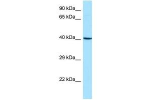 Western Blotting (WB) image for anti-Actin Related Protein 2/3 Complex, Subunit 1B, 41kDa (ARPC1B) (Middle Region) antibody (ABIN2790243)