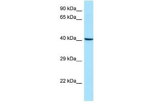 WB Suggested Anti-ARPC1B Antibody Titration: 1. (ARPC1B antibody  (Middle Region))