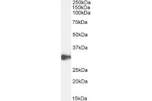 ABIN6391372 (0. (CLEC2D antibody  (Internal Region))