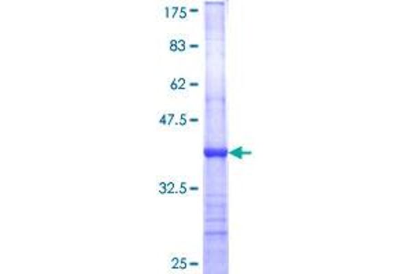 CPA3 Protein (AA 318-417) (GST tag)