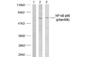 Western blot analysis of extracts using NF-κB p65 (phospho-Ser468) antibody (E011013). (NF-kB p65 antibody  (pSer468))