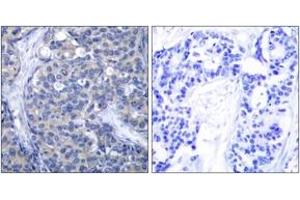 Immunohistochemistry (IHC) image for anti-zeta-Chain (TCR) Associated Protein Kinase 70kDa (ZAP70) (AA 286-335) antibody (ABIN2889082) (ZAP70 antibody  (AA 286-335))