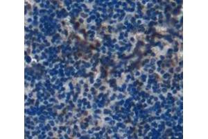 Used in DAB staining on fromalin fixed paraffin- embedded spleen tissue (LTA4H antibody  (AA 135-272))