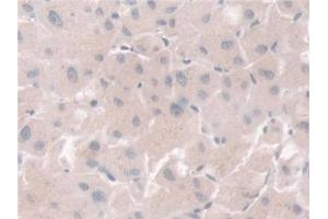Detection of PGM1 in Human Liver Tissue using Polyclonal Antibody to Phosphoglucomutase 1 (PGM1) (Phosphoglucomutase 1 antibody  (AA 1-235))