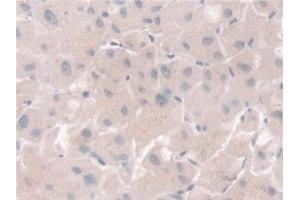 Detection of PGM1 in Human Liver Tissue using Polyclonal Antibody to Phosphoglucomutase 1 (PGM1)
