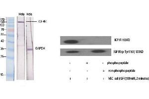 Western Blot (WB) analysis of specific cells using IGF-IR Polyclonal Antibody. (IGF1R antibody  (Ser1026))