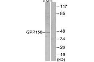 Western blot analysis of extracts from HuvEc cells, using GPR150 Antibody. (GPR150 antibody  (AA 361-410))