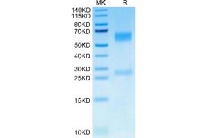 GGT1 Protein (AA 27-569) (His tag)