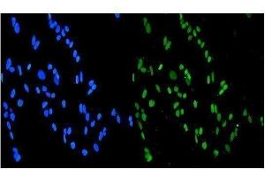IF analysis of SMURF1 using anti-SMURF1 antibody (ABIN3044547). (SMURF1 antibody  (Middle Region))