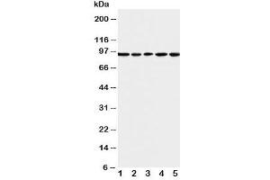 Western blot testing of MCM6 antibody and Lane 1:  U87;  2: COLO320;  3: HeLa;  4: MCF-7;  5: Jurkat cell lysate