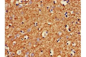 IHC image of ABIN7160401 diluted at 1:400 and staining in paraffin-embedded human brain tissue performed on a Leica BondTM system. (MBP antibody  (AA 1-197))
