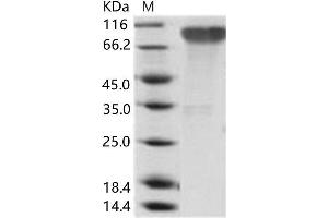 Epstein-Barr Virus Membrane Antigen gp350 (EBV gp350) protein (His tag)