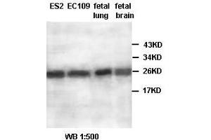 Image no. 2 for anti-Aldo-Keto Reductase Family 1, Member A1 (Aldehyde Reductase) (AKR1A1) antibody (ABIN791183) (AKR1A1 antibody)