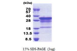 SDS-PAGE (SDS) image for Myelin Basic Protein (MBP) (AA 1-197) protein (His tag) (ABIN5853266)