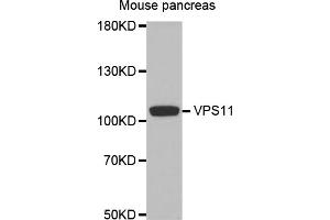 Western blot analysis of extracts of mouse pancreas, using VPS11 antibody. (VPS11 antibody)