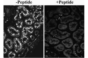 AP32082PU-N SLC26A6 Antibody overnight staining of paraffin embedded Human Kidney at 0. (SLC26A6 antibody  (Internal Region))