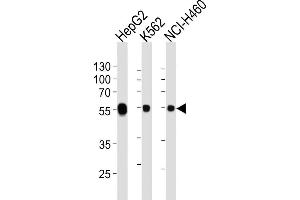 Lane 1: HepG2 Cell lysates, Lane 2: K562 Cell lysates, Lane 3: NCI-H460 Cell lysates, probed with ALDH1A1 (152CT1. (ALDH1A1 antibody)
