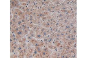 Used in DAB staining on fromalin fixed paraffin- embedded liver tissue (Neuroglobin antibody  (AA 1-151))