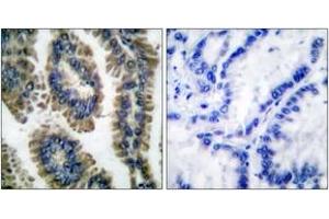 Immunohistochemistry (IHC) image for anti-Signal Transducer and Activator of Transcription 2, 113kDa (STAT2) (AA 656-705), (pTyr690) antibody (ABIN1531245)