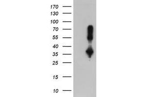 Western Blotting (WB) image for anti-Excision Repair Cross Complementing Polypeptide-1 (ERCC1) antibody (ABIN1498066) (ERCC1 antibody)