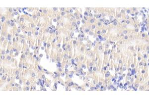 Detection of DLAT in Mouse Kidney Tissue using Polyclonal Antibody to Dihydrolipoyl Transacetylase (DLAT) (DLAT antibody  (AA 368-626))