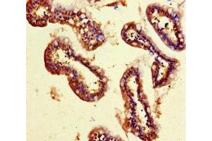 Immunohistochemistry of paraffin-embedded human small intestine tissue using ABIN7160774 at dilution of 1:100 (SMYD2A antibody  (AA 115-272))