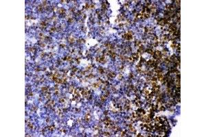 IHC-P: MCAK antibody testing of rat thymus tissue (KIF2C antibody  (AA 531-725))