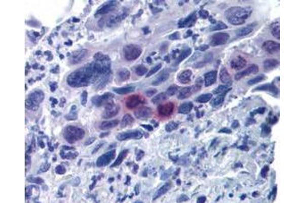 MLF1IP antibody  (pThr78)