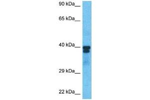 Host:  Rabbit  Target Name:  PAX6  Sample Type:  786-0 Whole Cell lysates  Antibody Dilution:  1. (PAX6 antibody  (C-Term))