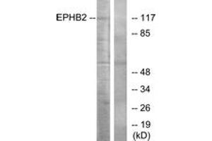 Western blot analysis of extracts from Jurkat cells, using EPHB2 Antibody. (EPH Receptor B2 antibody  (AA 991-1040))