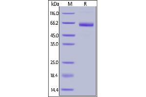 SDS-PAGE (SDS) image for Mesothelin (MSLN) (AA 296-580) (Active) protein (Fc Tag,FITC) (ABIN6731264)