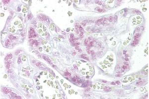 Immunohistochemistry with Placenta tissue at an antibody concentration of 10µg/ml using anti-CHEK2 antibody (ARP30290_P050) (CHEK2 antibody  (N-Term))