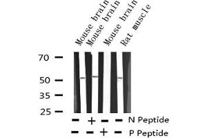 Western blot analysis of Phospho-ATF2 (Ser62 or 44) expression in various lysates (ATF2 antibody  (pSer44, pSer62))