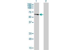 Western Blot analysis of PCTK2 expression in transfected 293T cell line by PCTK2 polyclonal antibody (A01). (CDK17 antibody  (AA 426-523))