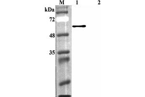 Western blot analysis using anti-FTO (human), pAb  at 1:4'000 dilution. (FTO antibody)