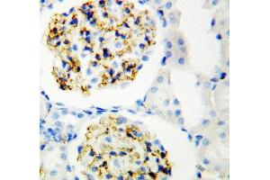 Immunohistochemistry (IHC) image for anti-CD34 (CD34) (AA 366-382), (C-Term) antibody (ABIN3044374)