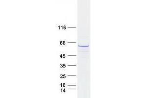 Western Blotting (WB) image for Chaperonin Containing TCP1, Subunit 3 (Gamma) (CCT3) (Transcript Variant 2) protein (Myc-DYKDDDDK Tag) (ABIN2718503)