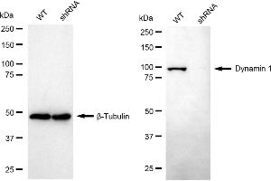 Western blotting analysis using dynamin 1 antibody (ABIN7798397). (Recombinant Dynamin 1 antibody)