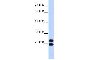 WB Suggested Anti-PRRX2 Antibody Titration:  0.