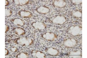Immunoperoxidase of monoclonal antibody to CSE1L on formalin-fixed paraffin-embedded human colon. (Exportin 2 antibody  (AA 872-971))