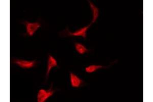 ABIN6275964 staining LOVO by IF/ICC. (GPR174 antibody  (Internal Region))